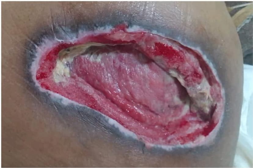 Before treatment